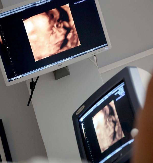 What Is A 3D Ultrasound?