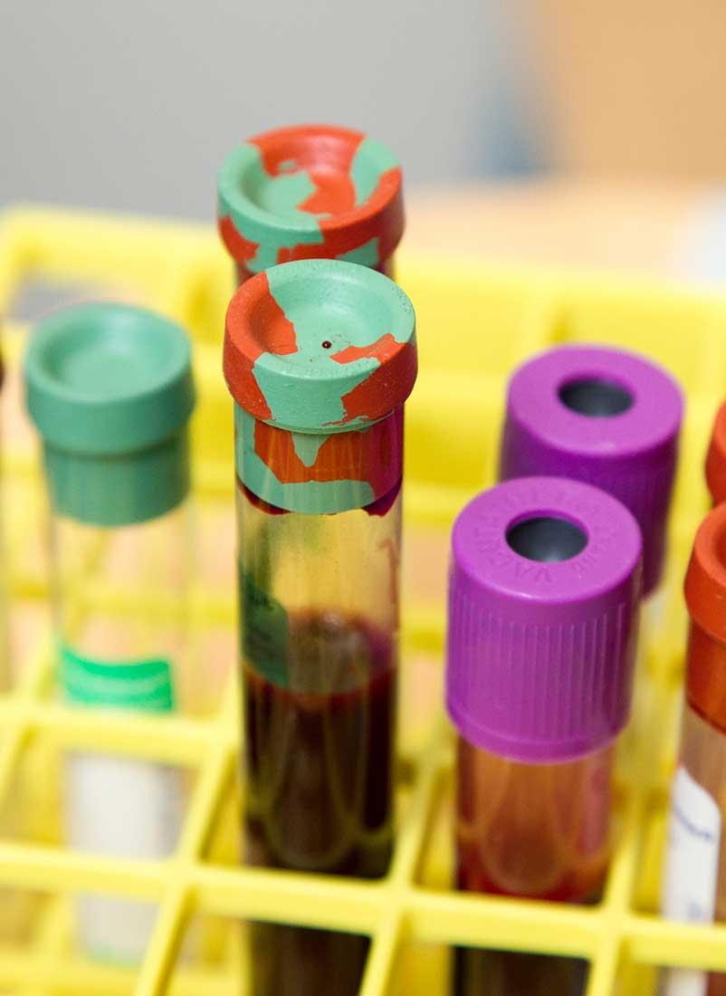 What You Need To Know About HIV In Georgia | Gwinnett OBGYN